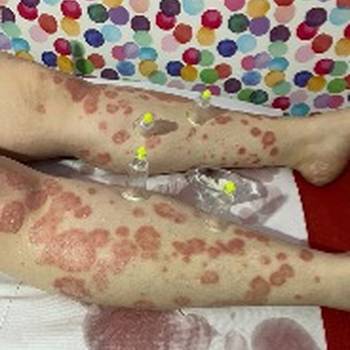 Hidzamom do balansa, Jaca